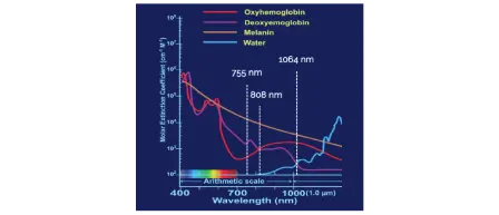 DI-REX 3 dalga boyu teknolojisini anlatan grafik