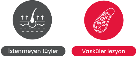 Q-MASTER PLUS cihazının epilasyon ve vasküler lezyon tedavi imkanları sunan long-pulsed modu