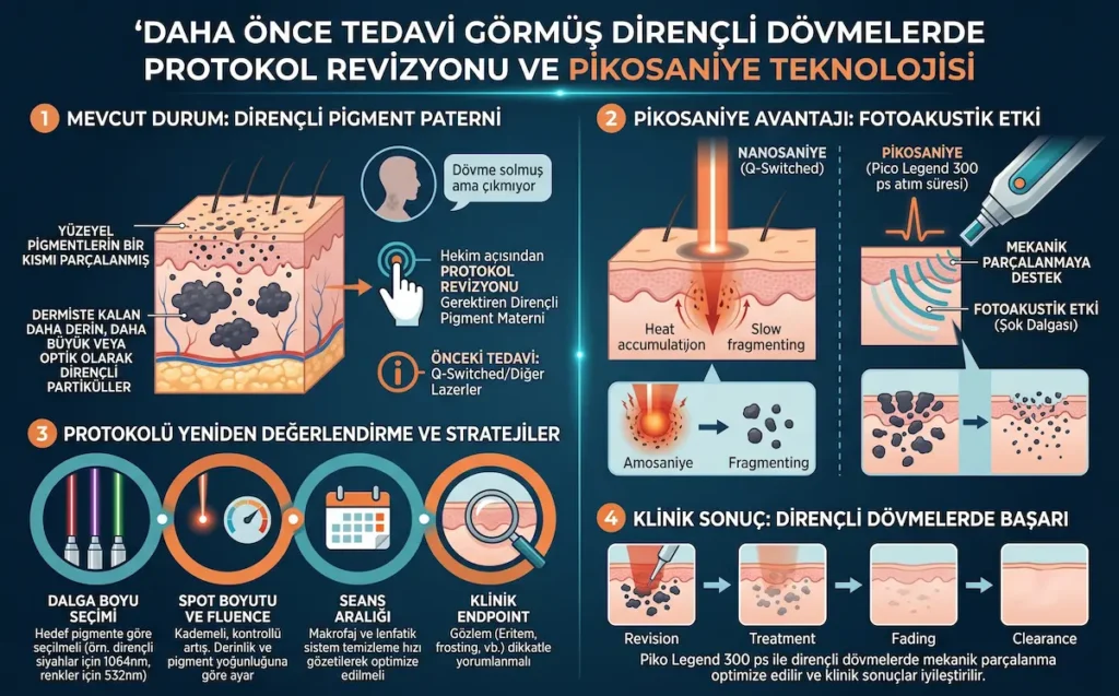 Daha önce tedavi görmüş dirençli dövmelerde pikosaniye lazer dövme silme protokol revizyonunu gösteren klinik infografik